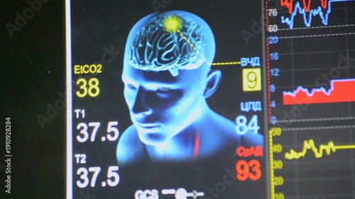 Modern patient monitor close-up. Electronic health monitor displaying medical indicators graphs of patient vital activity. Medical signs. Screen hospital computer monitor Cardiogram ECG Pulse