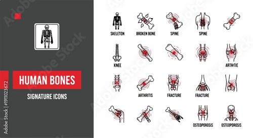 Human bones injury and orthopedic disease icons set with labels