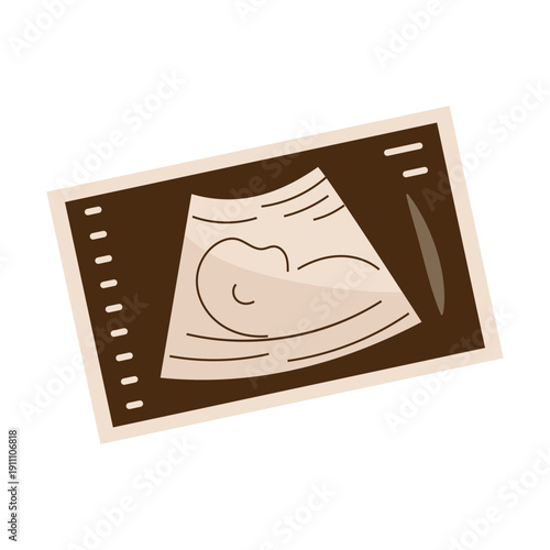 Ultrasound photo pregnancy concept illustration