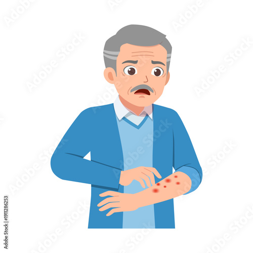 Elderly man showing red spots rash on his arm scratching it with a concerned worried expression