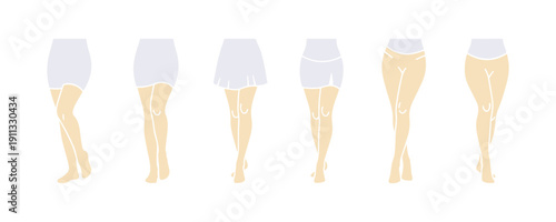 Legs beauty icon. 6 diverse styles. Editable stroke. Vector graphic.