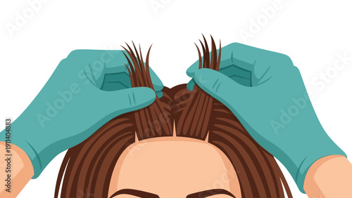 Hair scalp examination by gloved hands in a flat style vector art