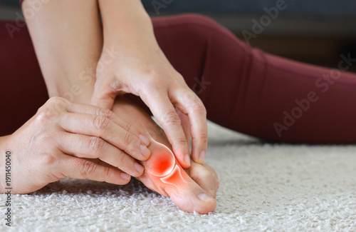 Tableau sur toile Close up of woman massaging painful big toe with anatomical joint illustration and red highlight