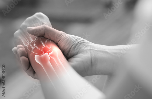 Fotografía Woman massaging her painful wrist with anatomical bone illustration and red highlight
