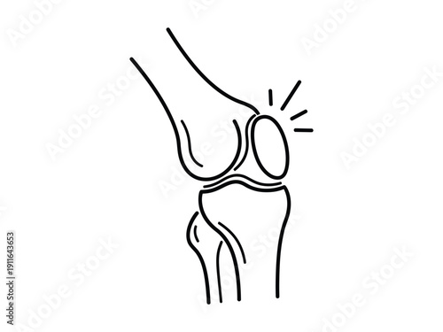 Knee joint bone illustration with pain symbol, vector graphic for medical and orthopedic needs