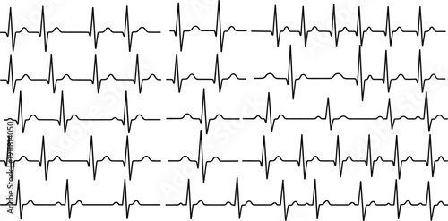 Electrocardiogram heartbeat waveform pattern set with medical ECG signal line art vector illustration