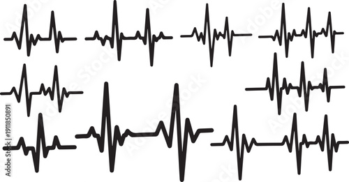Collection of various ECG heartbeat rhythm tracings on screen