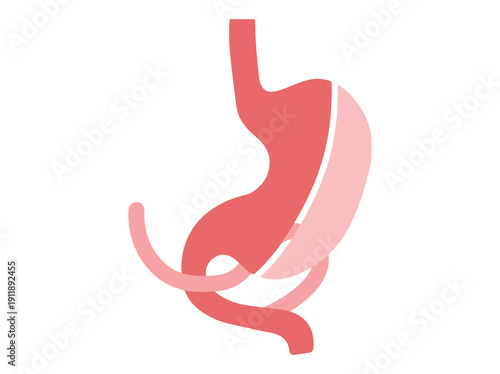 biliopancreatic diversion duodenal switch surgery
