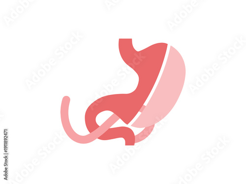 biliopancreatic diversion with duodenal switch surgery
