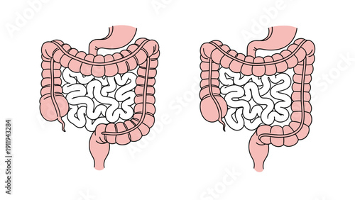 Two illustrations of the human digestive tract showing the stomach and intestines in detail for medical education and health themes.