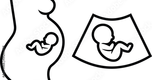 Fetus and Pregnancy Ultrasound Silhouette Icons Isolated on White Background, Prenatal Baby Development Symbol, Medical Maternity and Obstetric Healthcare Concept Illustration