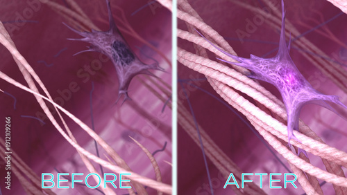 Tablou pe pânză Skin collagen fibers before and after anti-aging wrinkle reduction treatment