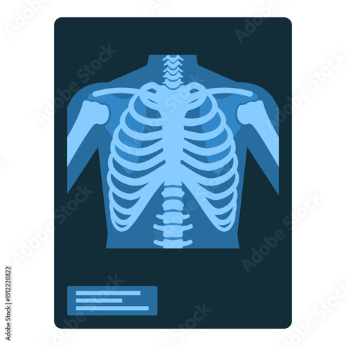 Medical records: x-ray image of rib cage and lungs