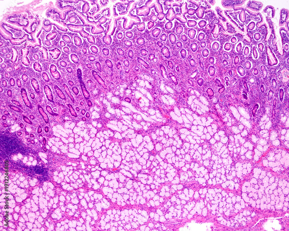 Fototapeta premium Duodenum. Brunner’s glands