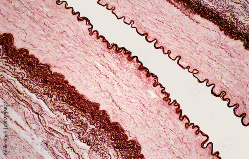 Muscular artery