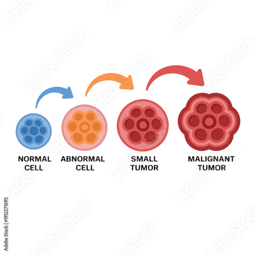 Tumor Development Stages Illustration