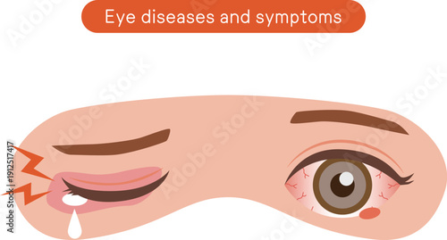 目の病気と症状