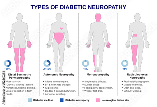 Types of Diabetic Neuropathy Flashcard