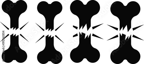 Broken bone silhouette set with cracked fracture shapes, bold black medical injury icons for healthcare concepts, danger symbols, warning graphics, and graphic design projects