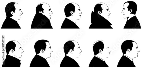 Minimalist icons show balding men in profile with varying hair loss stages on white background