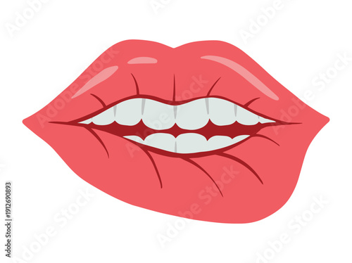 Granulomatous Cheilitis Lip Disease