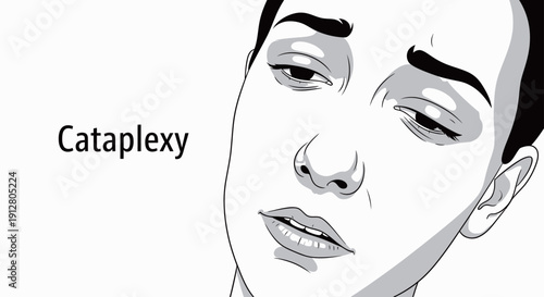 Illustration of cataplexy symptoms showing a person with drooping eyelids and loss of facial muscle tone.