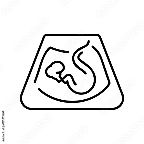 Ultrasound image showing an embryo in a triangular frame  