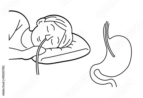 Endoscopy Examination with Stomach Anatomy Line Art Medical Illustration for Gastroenterology and Healthcare Education