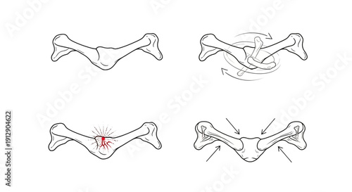 Cervical Vertebrae Fracture and Injury Diagram