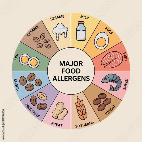 Major food allergens infographic with icons and labels  common allergy sources