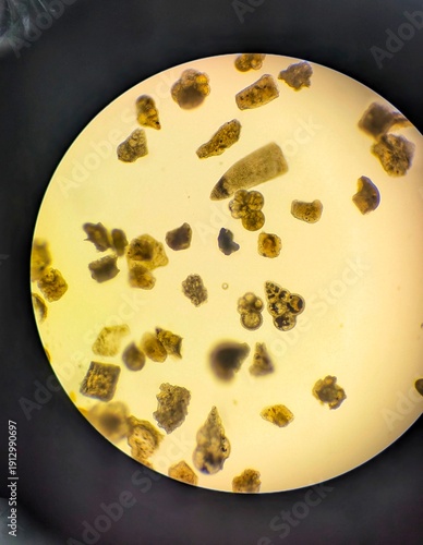 Obraz na plátně Light micrographs of foraminifera, unicellular protists with diverse shell-like tests