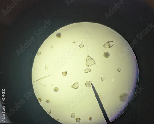 Fotografie Light micrograph of radiolaria, unicellular eukaryotic zooplankton found worldwide