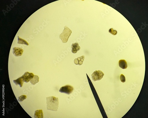 Fotografie Light micrographs of foraminifera, unicellular protists with diverse shell-like tests