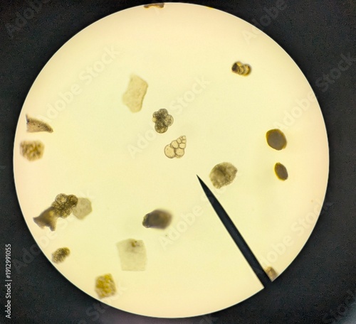 Obraz na plátně Light micrographs of foraminifera, unicellular protists with diverse shell-like tests