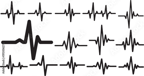 Collection of various ECG heartbeat waveform patterns on screen