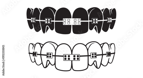Black and white illustration of dental braces on teeth, orthodontic treatment concept, isolated on Transparent Background, detailed and clear.