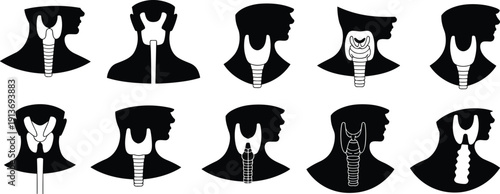 Medical Icon Set Featuring Human Neck Silhouettes with Thyroid Gland and Trachea Anatomy for Endocrine System Health Thyroiditis Goiter Diagnosis Healthcare Education and Wellness Design