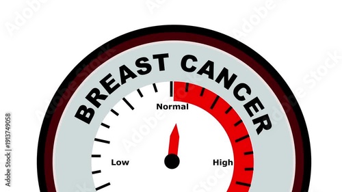Breast cancer text or word displayed with a barometer or tachometer-style gauge showing levels from low to normal to high, symbolizing the stages and severity of breast cancer