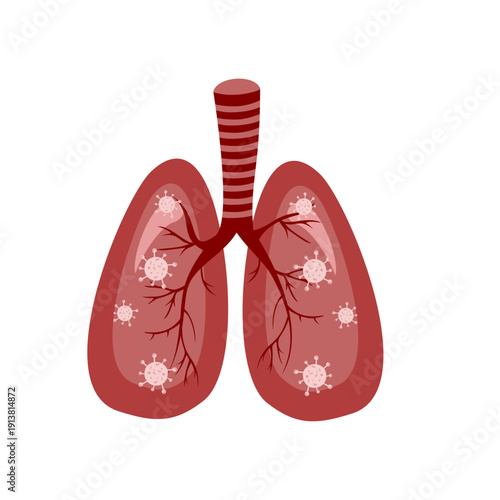 Lungs infected with a virus, pneumonia. Concept of lungs with viruses, bacteria, and microbes isolated on a white background. Coronavirus warning sign.