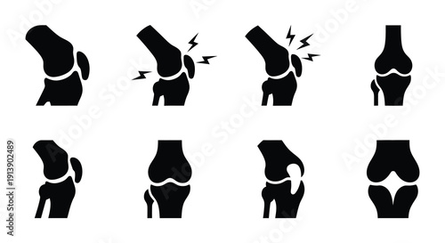 Illustrations of human knees including healthy and injured states