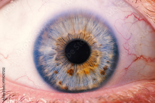 human eye with a heart shaped spot