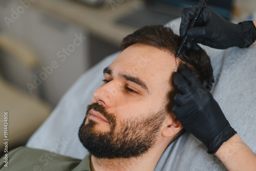 Foto Patient receiving hair transplant consultation planning treatment