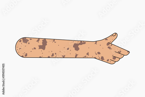 Vitiligo thumbs up hand, gesture collage element vector