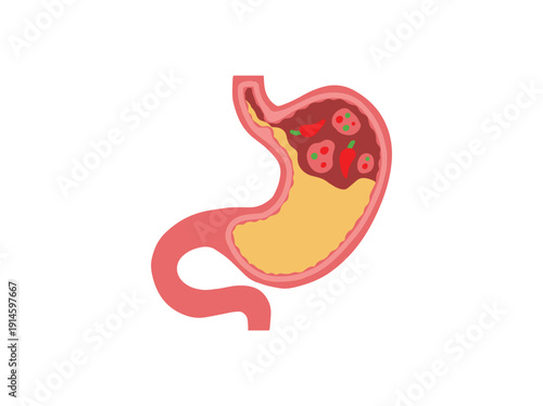 Hand Drawn Dyspepsia Disease Stomach
