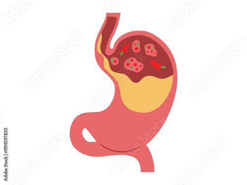Hand Drawn Dyspepsia Disease Stomach