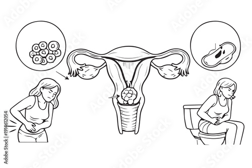 A vector illustration showing cervical cancer education concept using health symbols, created for medical awareness, prevention learning, and education theme.