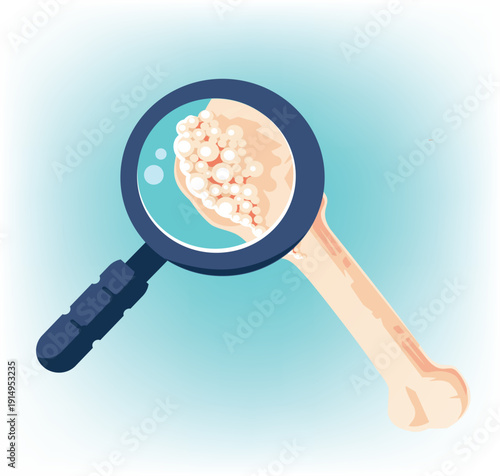 Medical illustration Concept of Analyzes Magnifying Glass Over Calcific Bone Examination