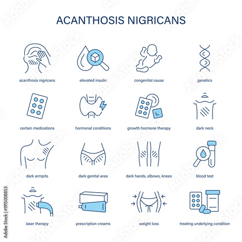 Acanthosis Nigricans symptoms, diagnostic and treatment vector icon set