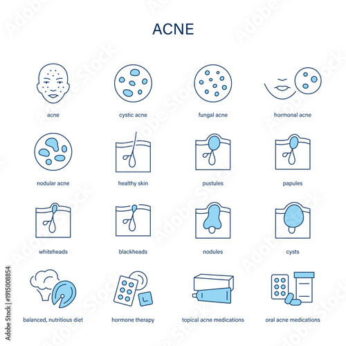 Acne symptoms, diagnostic and treatment vector icon set