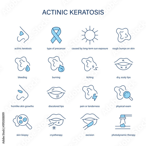 Actinic Keratosis symptoms, diagnostic and treatment vector icon set